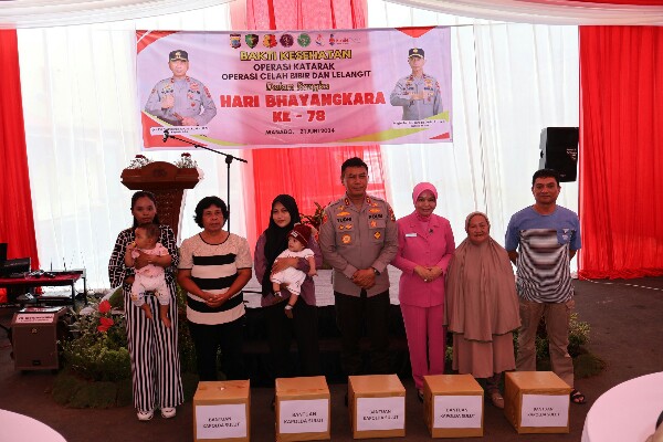 Polda Sulut Polda Sulut Gelar Bakti Kesehatan Operasi Celah Bibir dan Katarak
